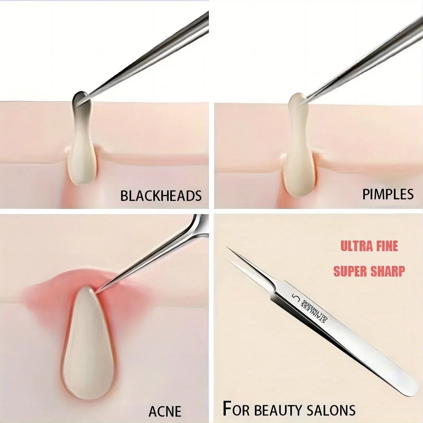 Cellular Acne Blackhead Tweezers - Facial Beauty Remove Acne Needle