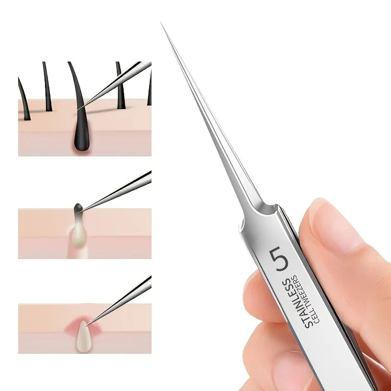 Cellular Acne Blackhead Tweezers - Facial Beauty Remove Acne Needle