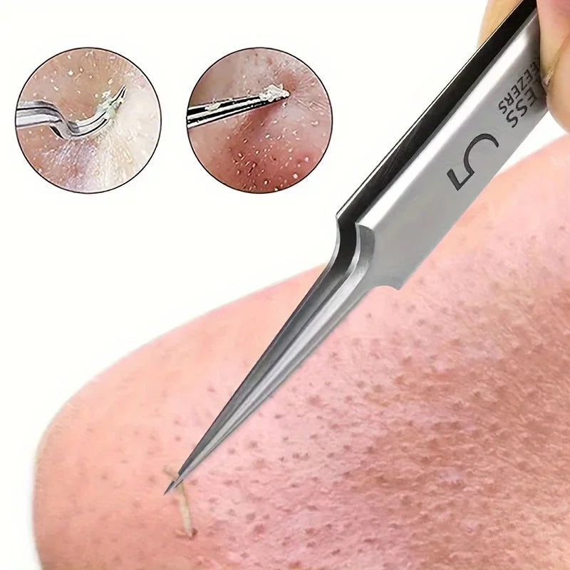 Cellular Acne Blackhead Tweezers - Facial Beauty Remove Acne Needle